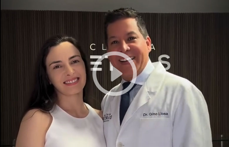 Testimonio 3 Endoscopic Deep Plane Facelift en Perú - Dr. Gino Llosa